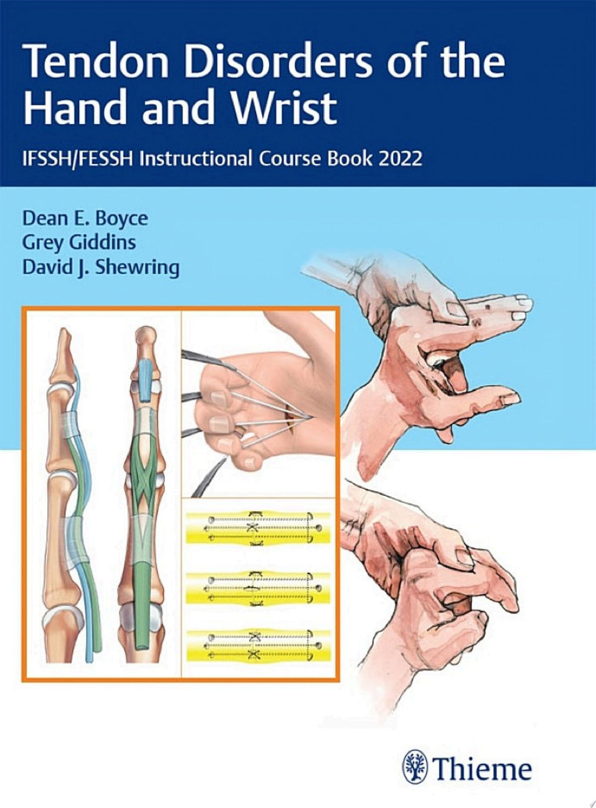 Tendon Disorders of the Hand and Wrist: IFSSH/FESSH Instructional Course Book 2022