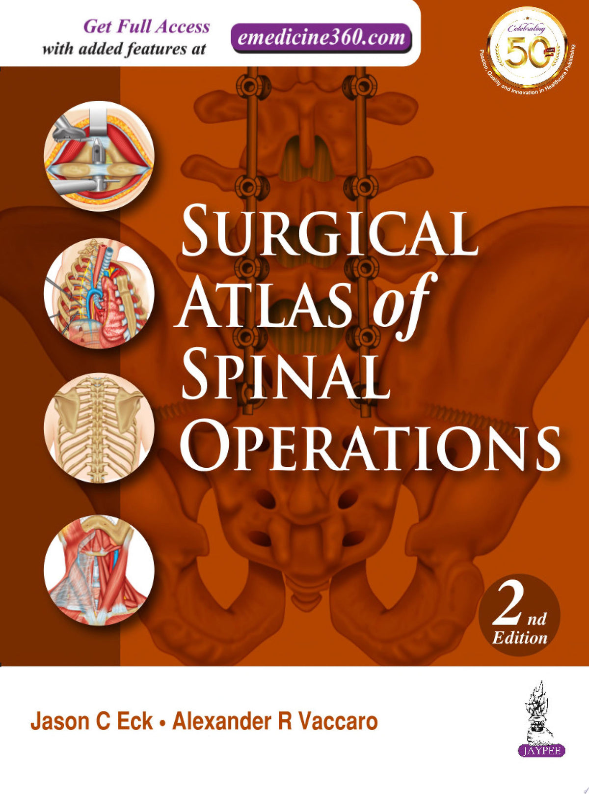 Surgical Atlas of Spinal Operations, 2nd Edition