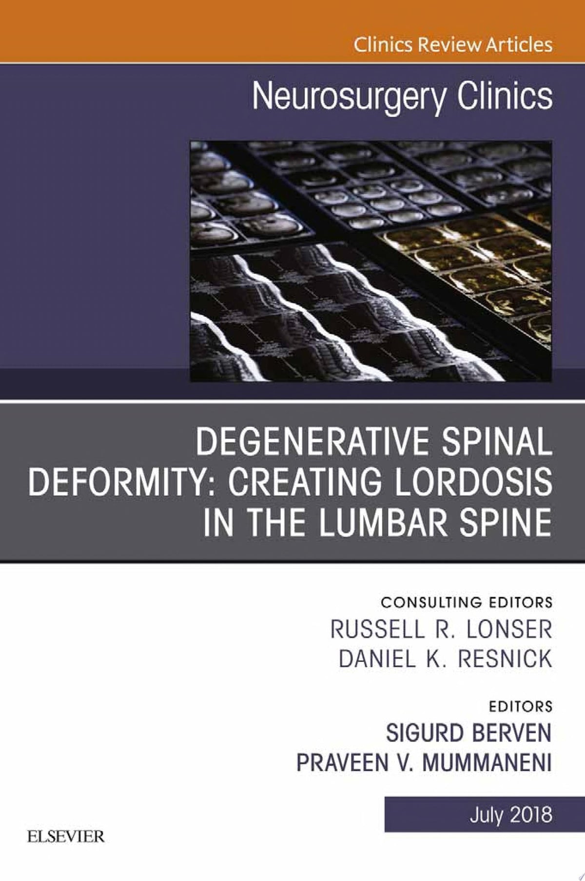 Degenerative Spinal Deformity: Creating Lordosis in the Lumbar Spine, An Issue of Neurosurgery Clinics of North America (Volume 29-3) (The Clinics: Surgery, Volume 29-3)