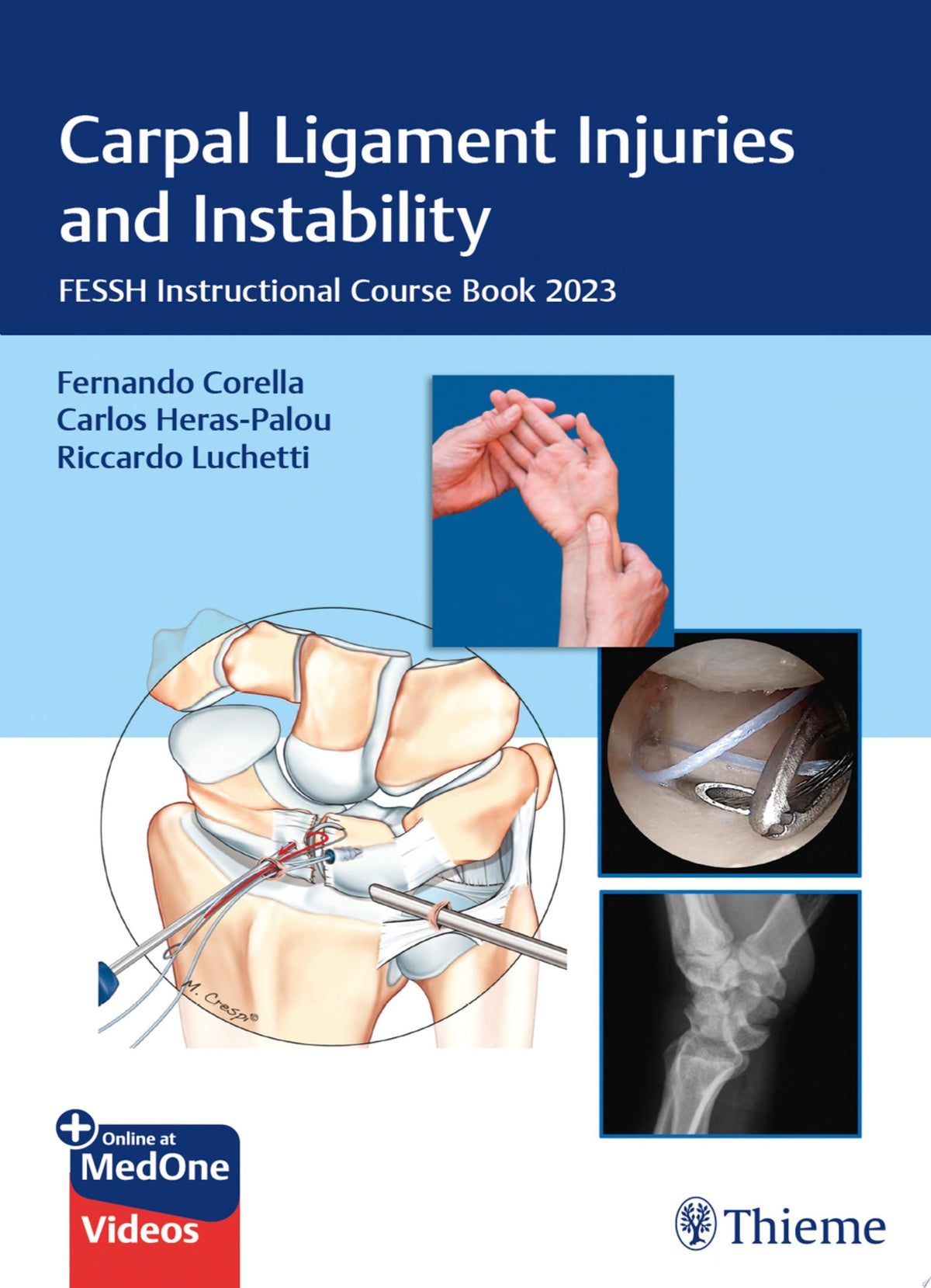 Carpal Ligament Injuries and Instability: FESSH Instructional Course Book 2023