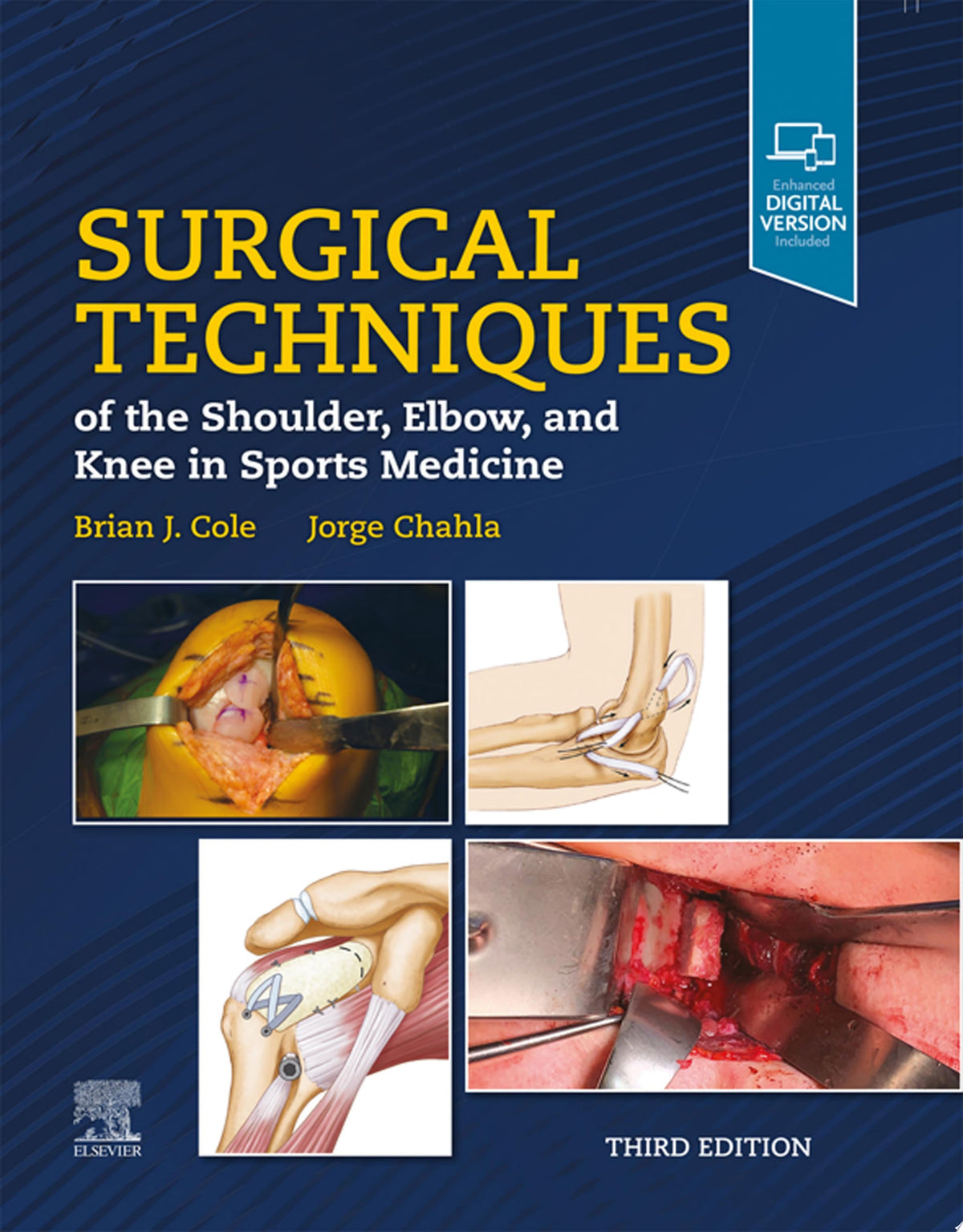 Surgical Techniques of the Shoulder, Elbow, and Knee in Sports Medicine, 3rd Edition