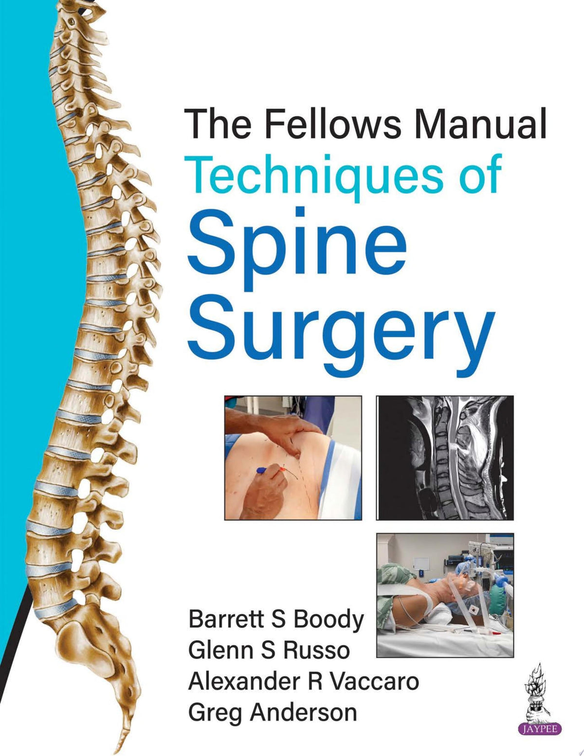 The Fellows Manual Techniques of Spine Surgery