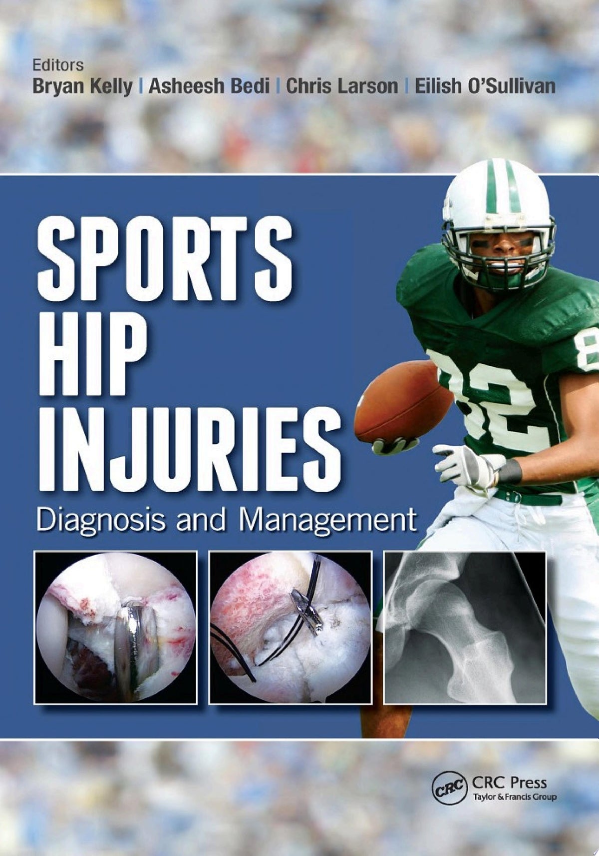 Sports Hip Injuries Diagnosis and Management