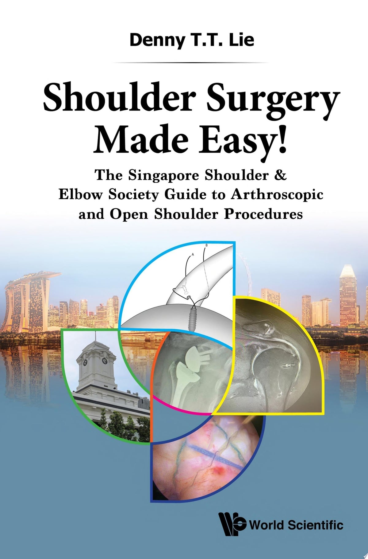 Shoulder Surgery Made Easy!: The Singapore Shoulder & Elbow Society Guide to Arthroscopic and Open Shoulder Procedures