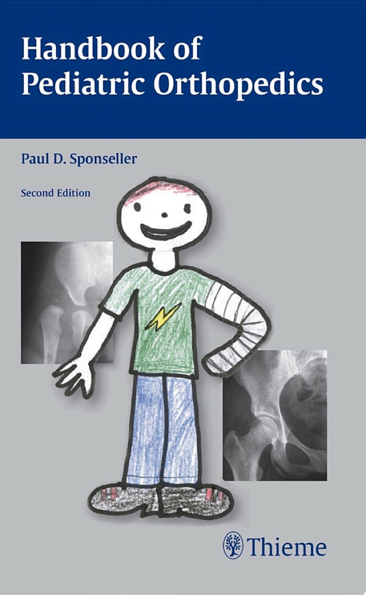 Handbook of Pediatric Orthopedics, 2nd Edition
