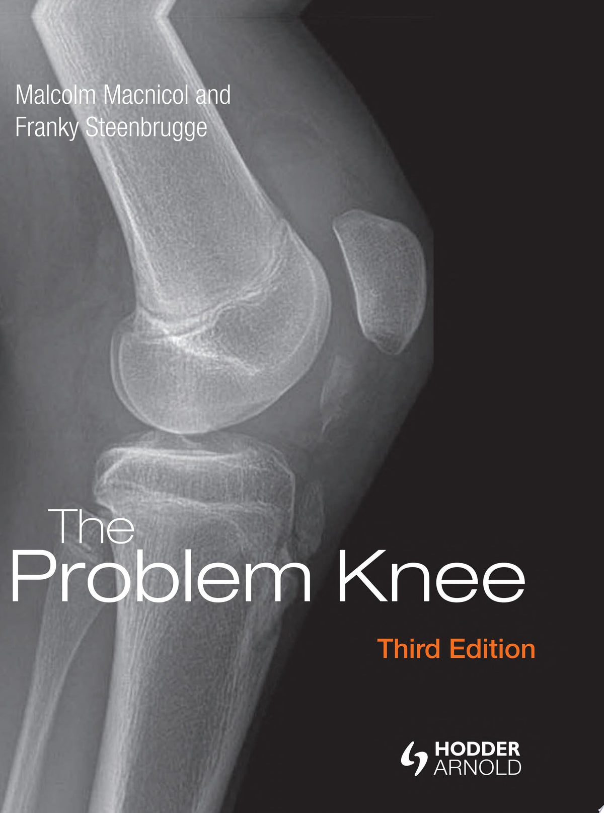 The Problem Knee, 3rd Edition