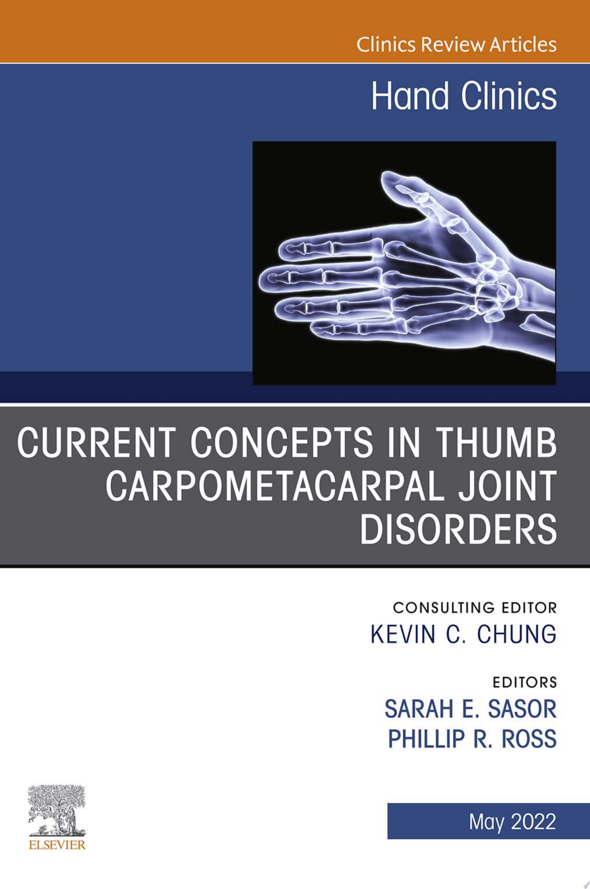 Current Concepts in Thumb Carpometacarpal Joint Disorders, An Issue of Hand Clinics (Volume 38-2) (The Clinics: Internal Medicine, Volume 38-2)