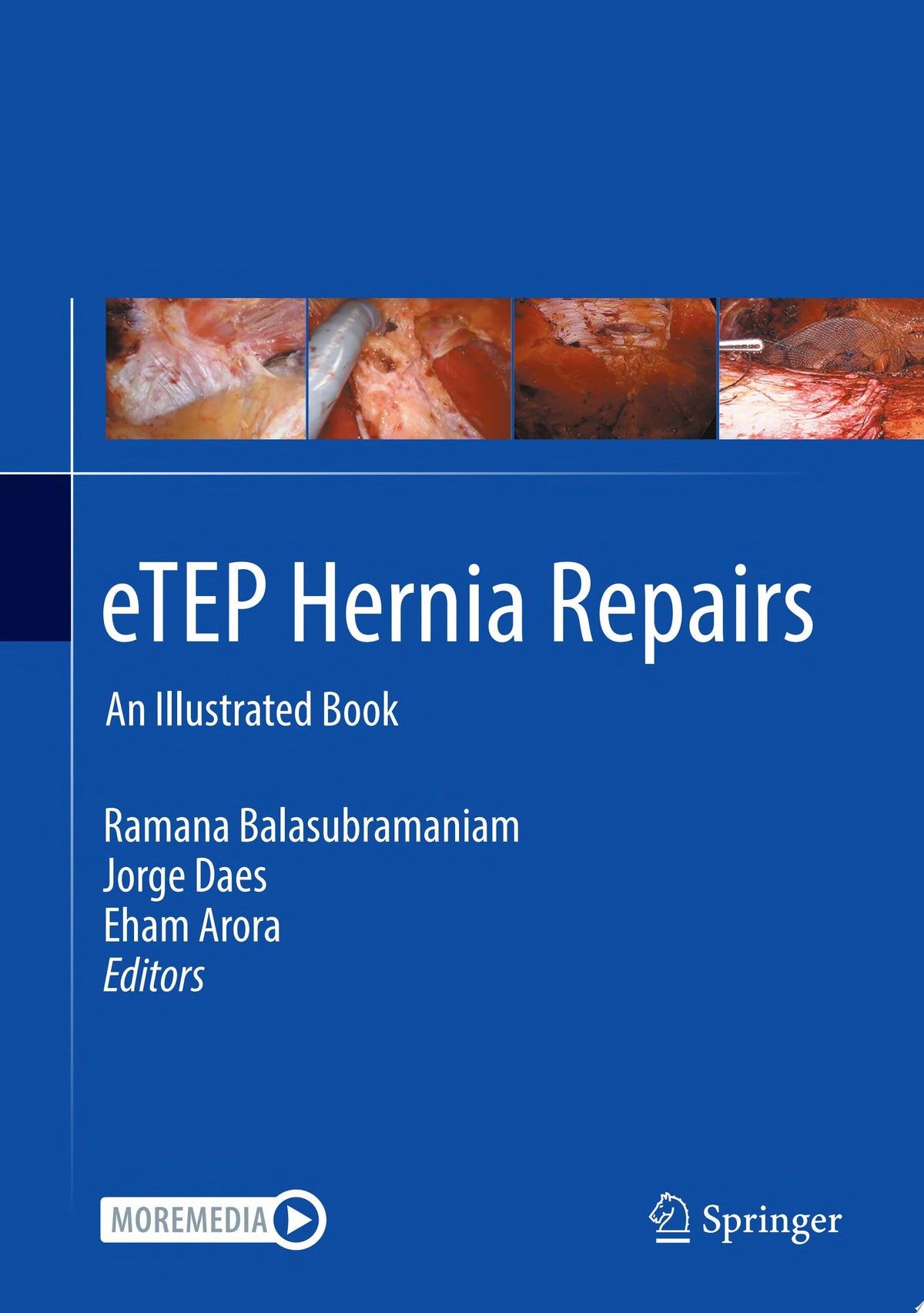 eTEP Hernia Repairs: An Illustrated Book