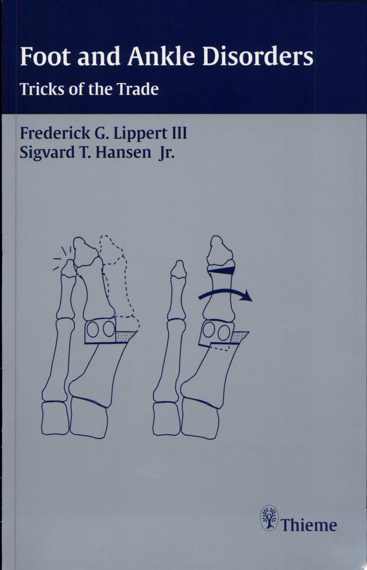 Foot and Ankle Surgery: Tricks of the Trade 1st Edition