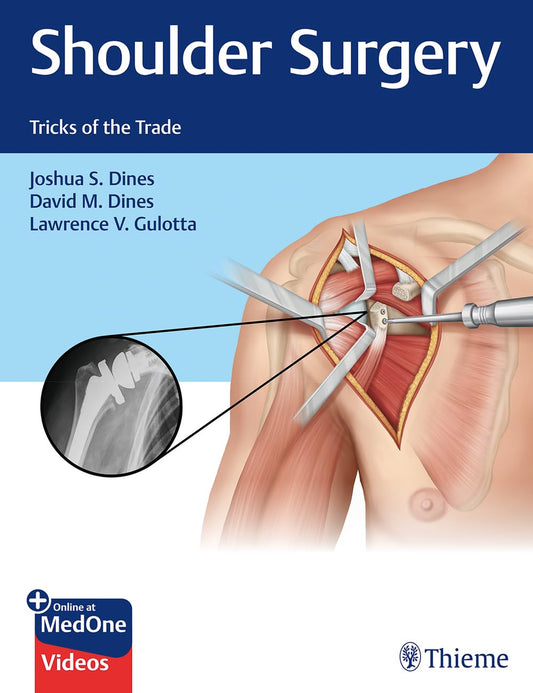 Shoulder Surgery: Tricks of the Trade (PDF)