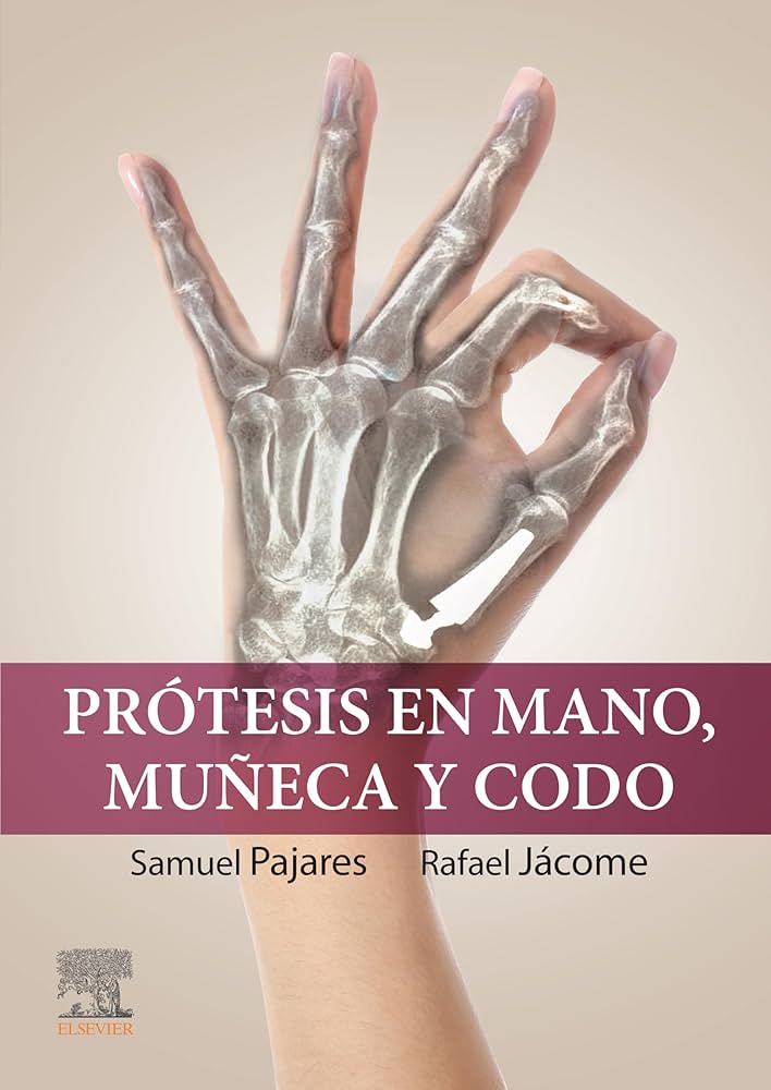 Prótesis en mano, muñeca y codo