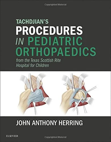 Tachdjian’s Procedures in Pediatric Orthopaedics: From the Texas Scottish Rite Hospital for Children