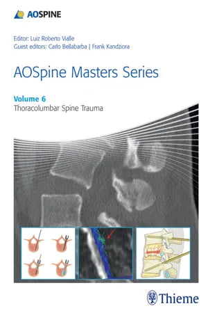 AOSpine Masters Series, Volume 6: Thoracolumbar Spine Trauma (ORIGINAL PDF from Publisher)