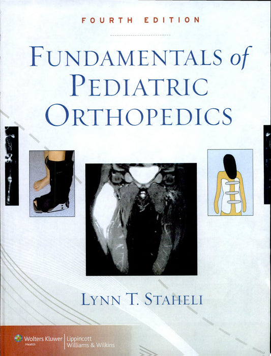 Fundamentals of Pediatric Orthopedics, 4th Edition