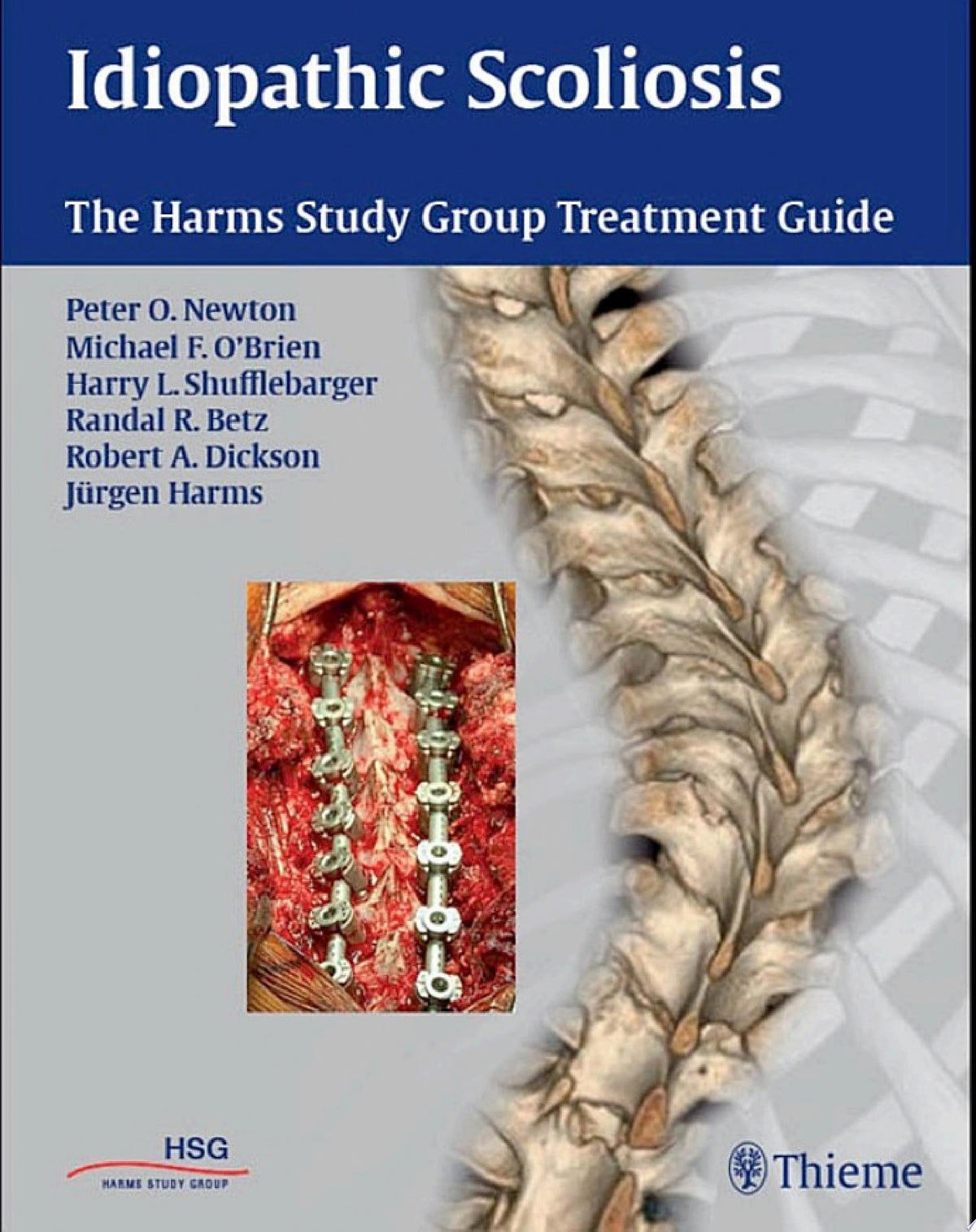 Idiopathic Scoliosis: The Harms Study Group Treatment Guide, 1st edition