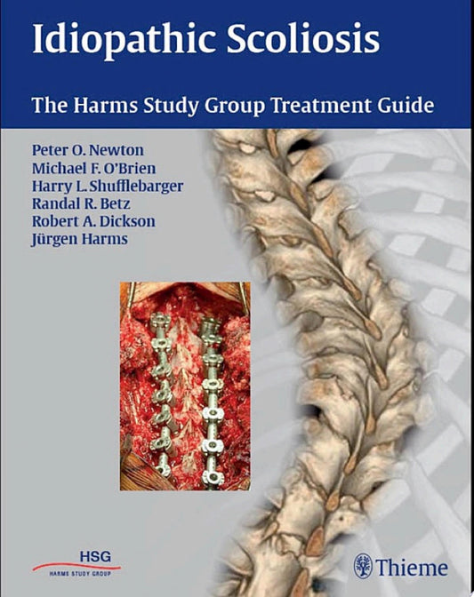 Idiopathic Scoliosis: The Harms Study Group Treatment Guide, 1st edition