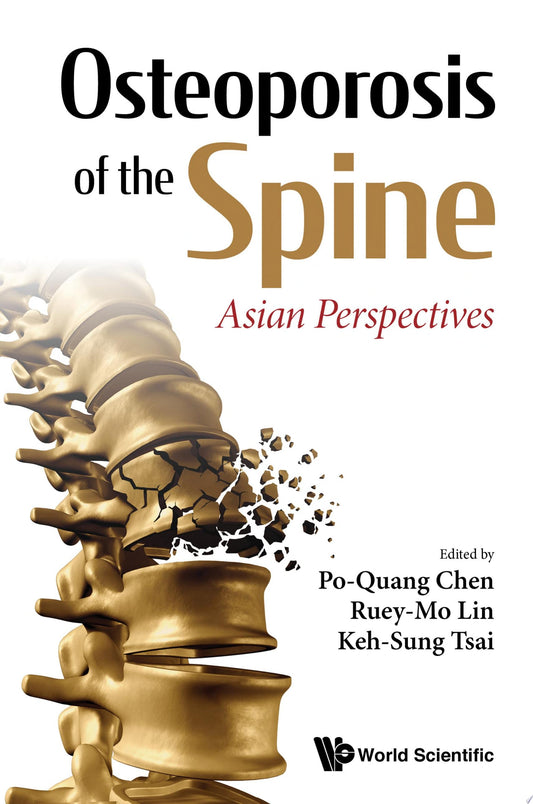 Osteoporosis of the Spine: Asian Perspectives