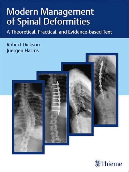 Modern Management of Spinal Deformities: A Theoretical, Practical, and Evidence-based Text