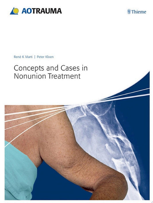 Concepts and Cases in Nonunion Treatment (AO Trauma Handbooks)