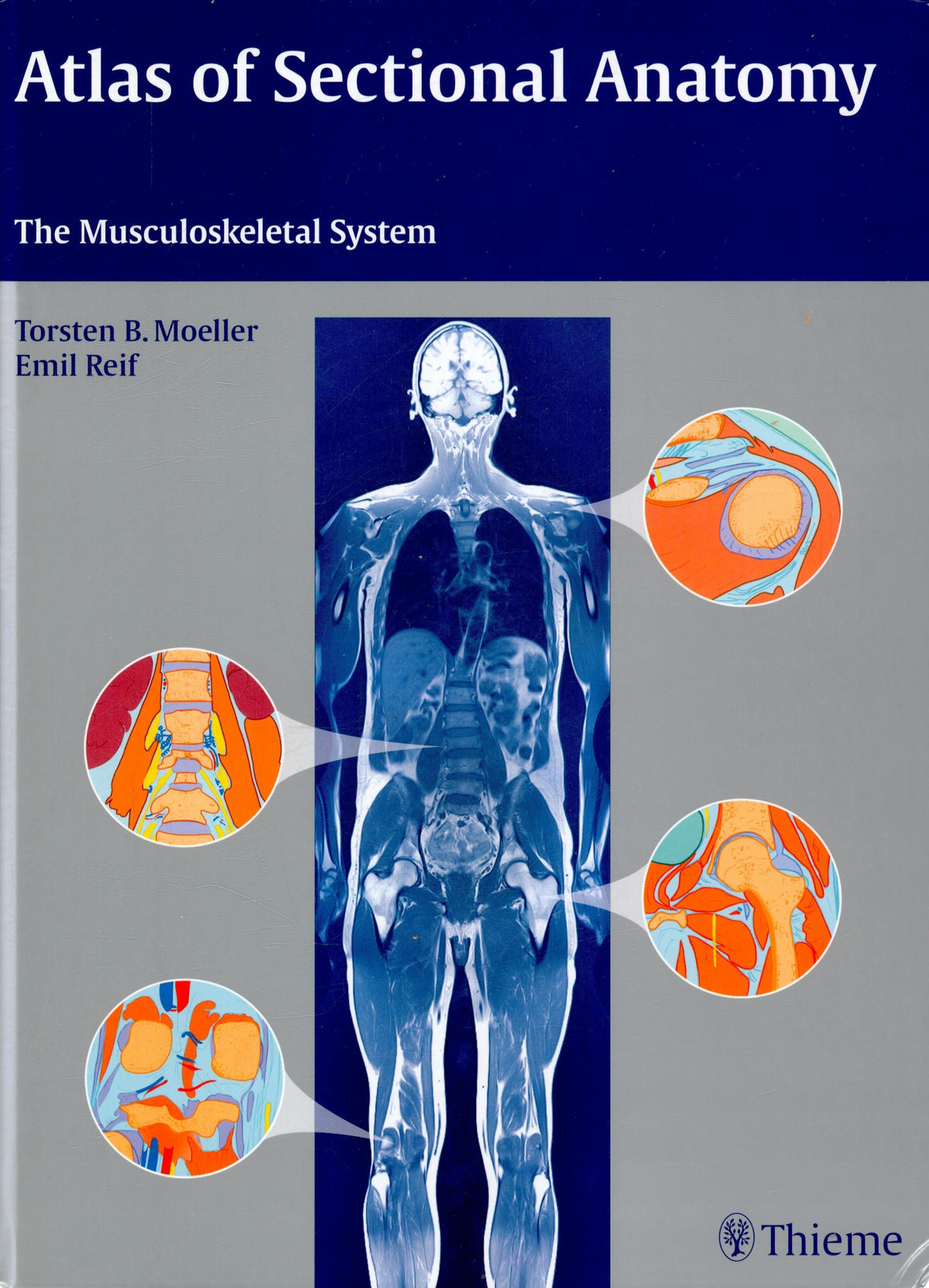 Atlas of Sectional Anatomy: The Musculoskeletal System