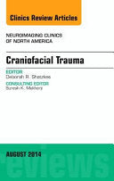 Craniofacial Trauma, An Issue of Neuroimaging Clinics
