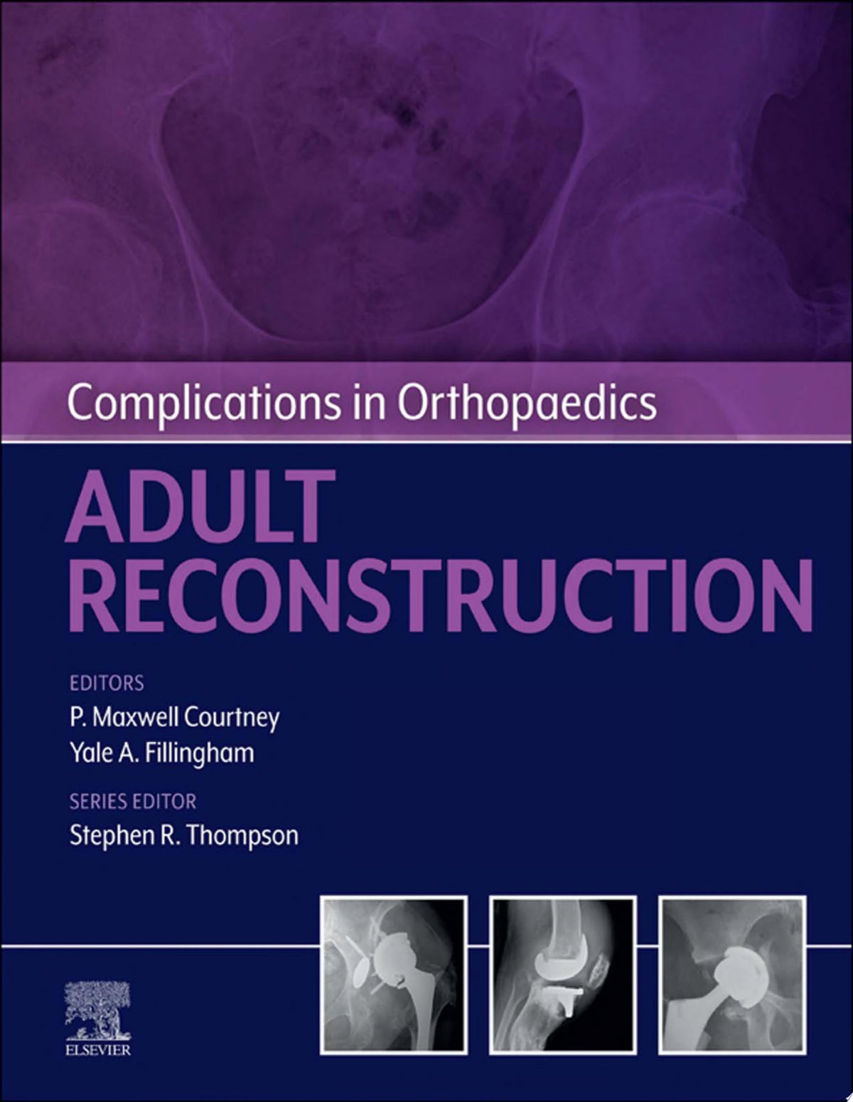 Complications in Orthopaedics: Adult Reconstruction