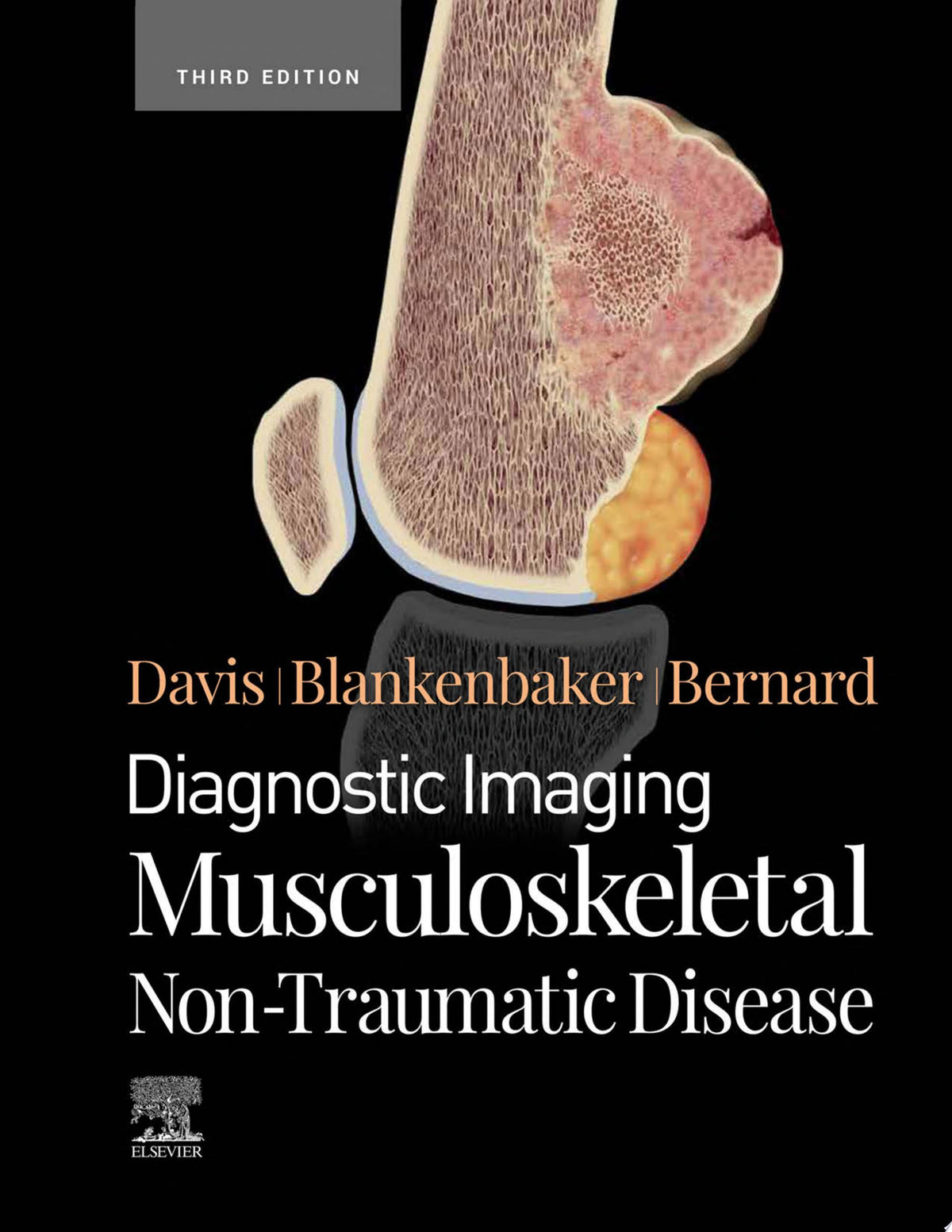 Diagnostic Imaging: Musculoskeletal Non-Traumatic Disease, 3rd Edition