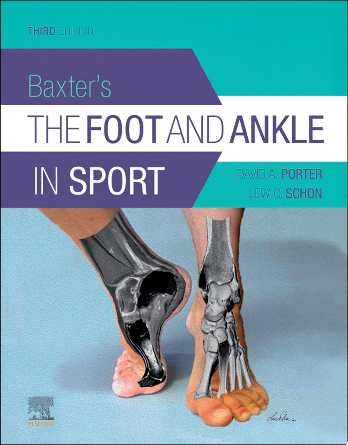 Baxter’s The Foot And Ankle In Sport, 3rd Edition