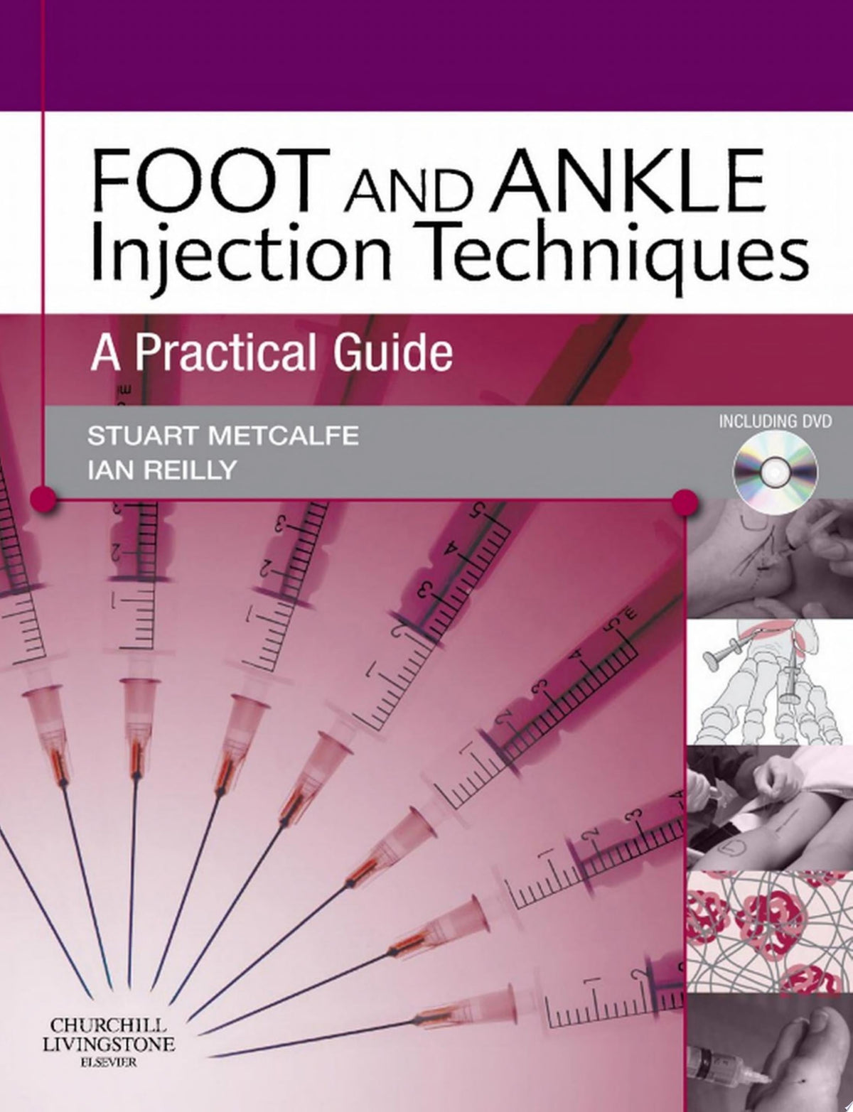 Foot and Ankle Injection Techniques: A Practical Guide 1st Edition (Original PDF From Publisher)