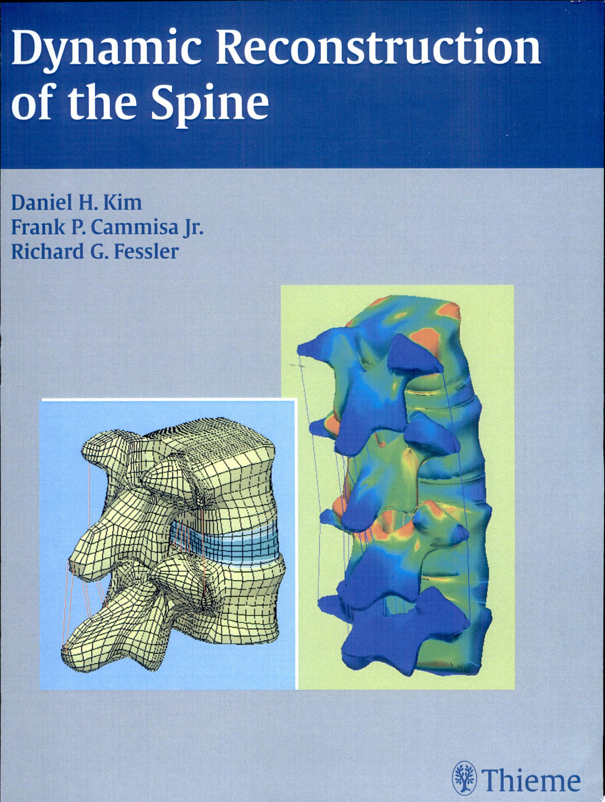 Dynamic Reconstruction of the Spine