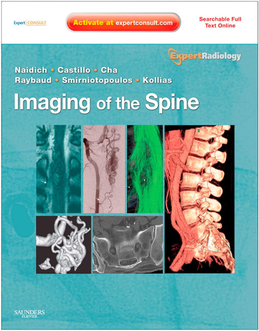 Imaging of the Spine: Expert Radiology Series, Expert Consult-Online and Print