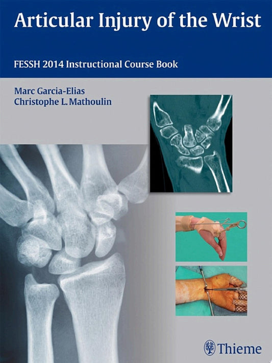 Articular Injury of the Wrist: FESSH 2014 Instructional Course Book (ORIGINAL PDF from Publisher)