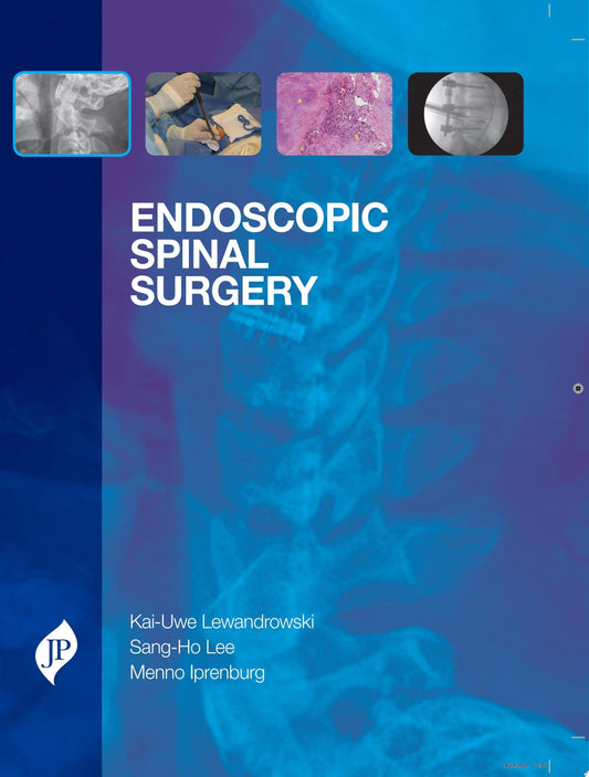 50 Landmark Papers Every Spine Surgeon Should Know (PDF)