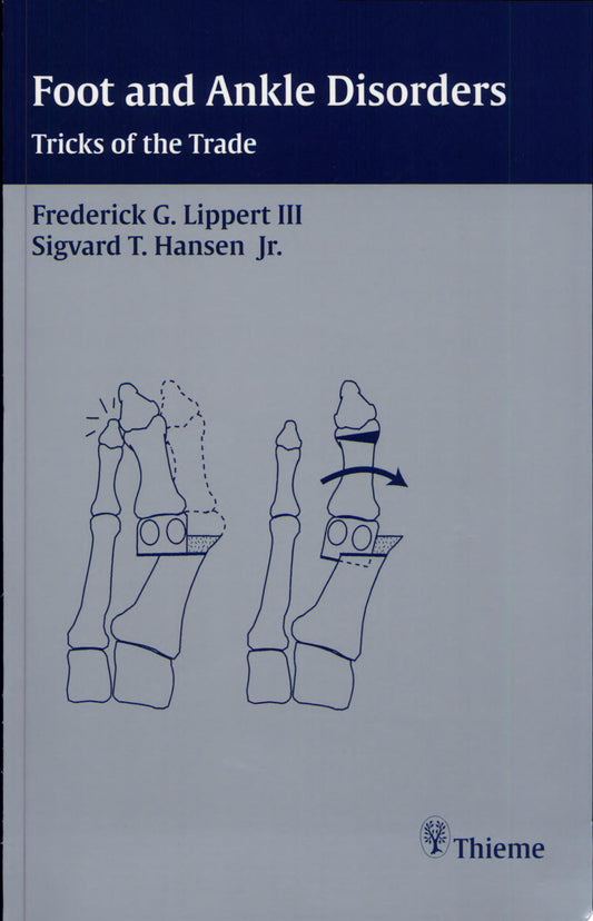 Foot and Ankle Surgery: Tricks of the Trade 1st Edition