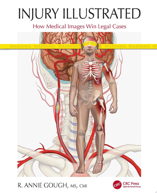 Injury Illustrated: How Medical Images Win Legal Cases