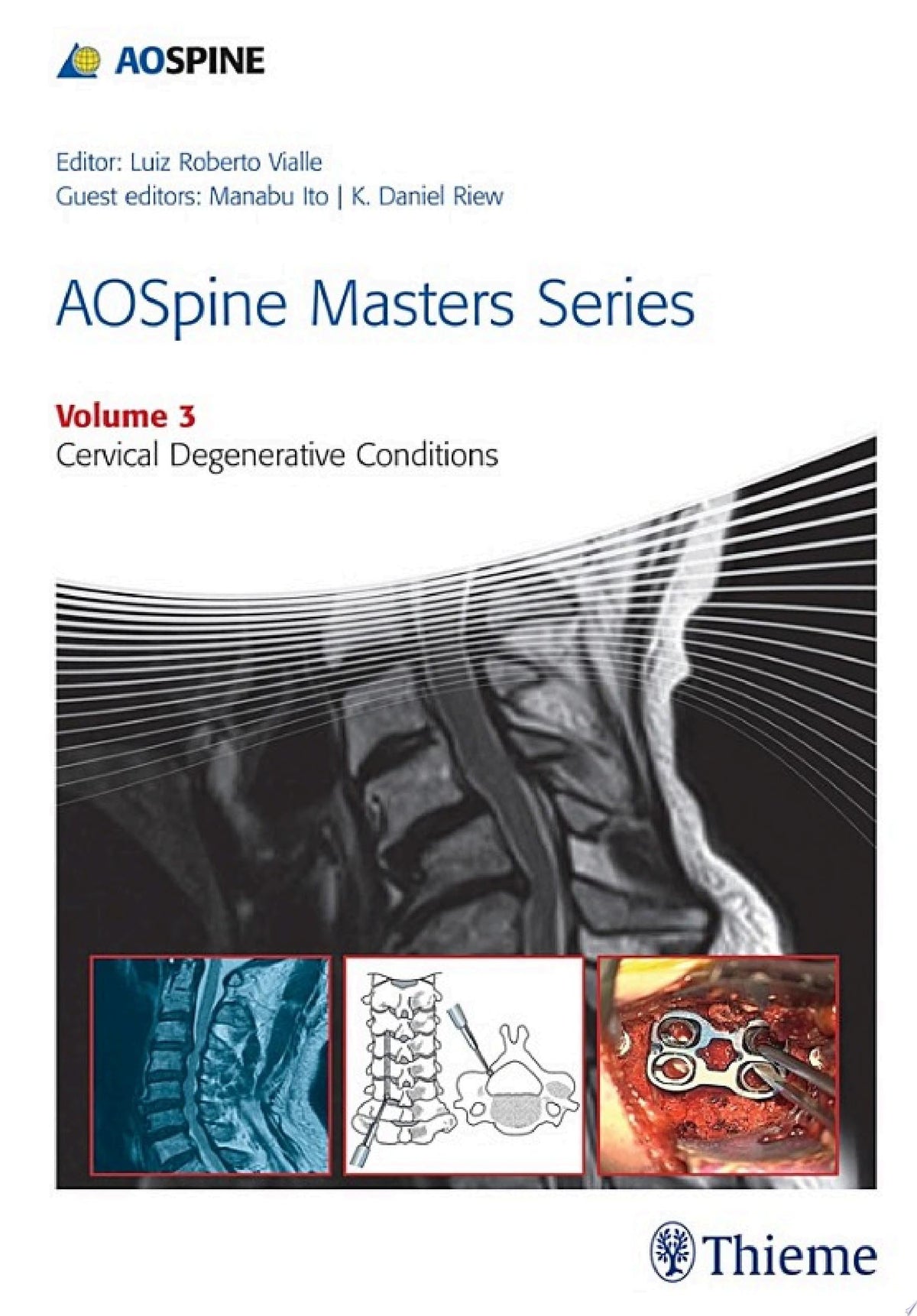 AOSpine Masters Series Volume 3: Cervical Degenerative Conditions