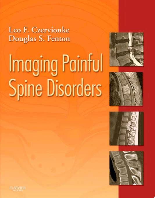 Imaging Painful Spine Disorders