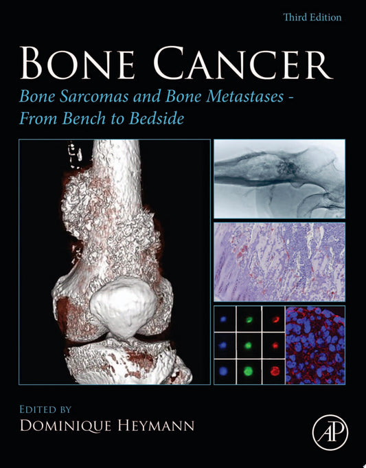 Bone Cancer: Bone Sarcomas and Bone Metastases – From Bench to Bedside, 3rd Edition