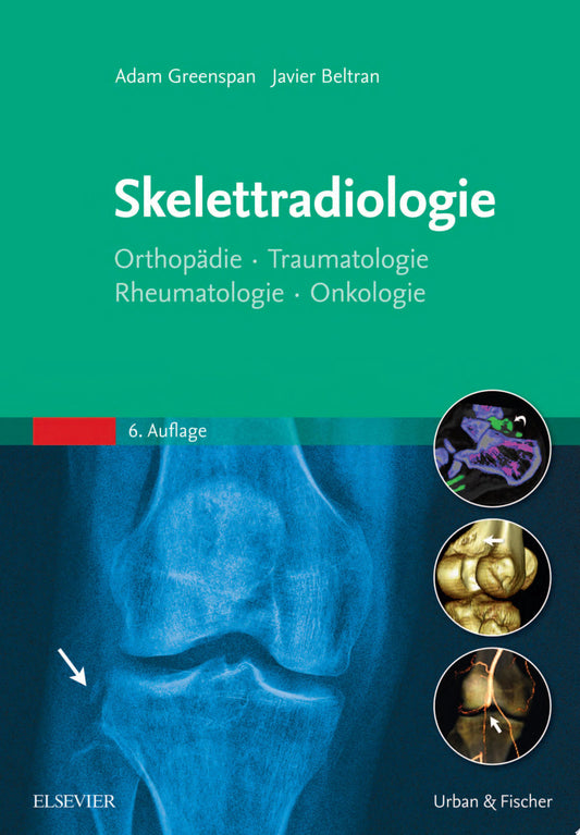 Musculoskeletal MRI, 2nd Edition